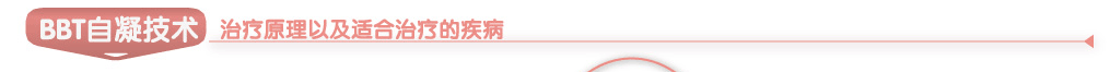 “BBT”自凝技术